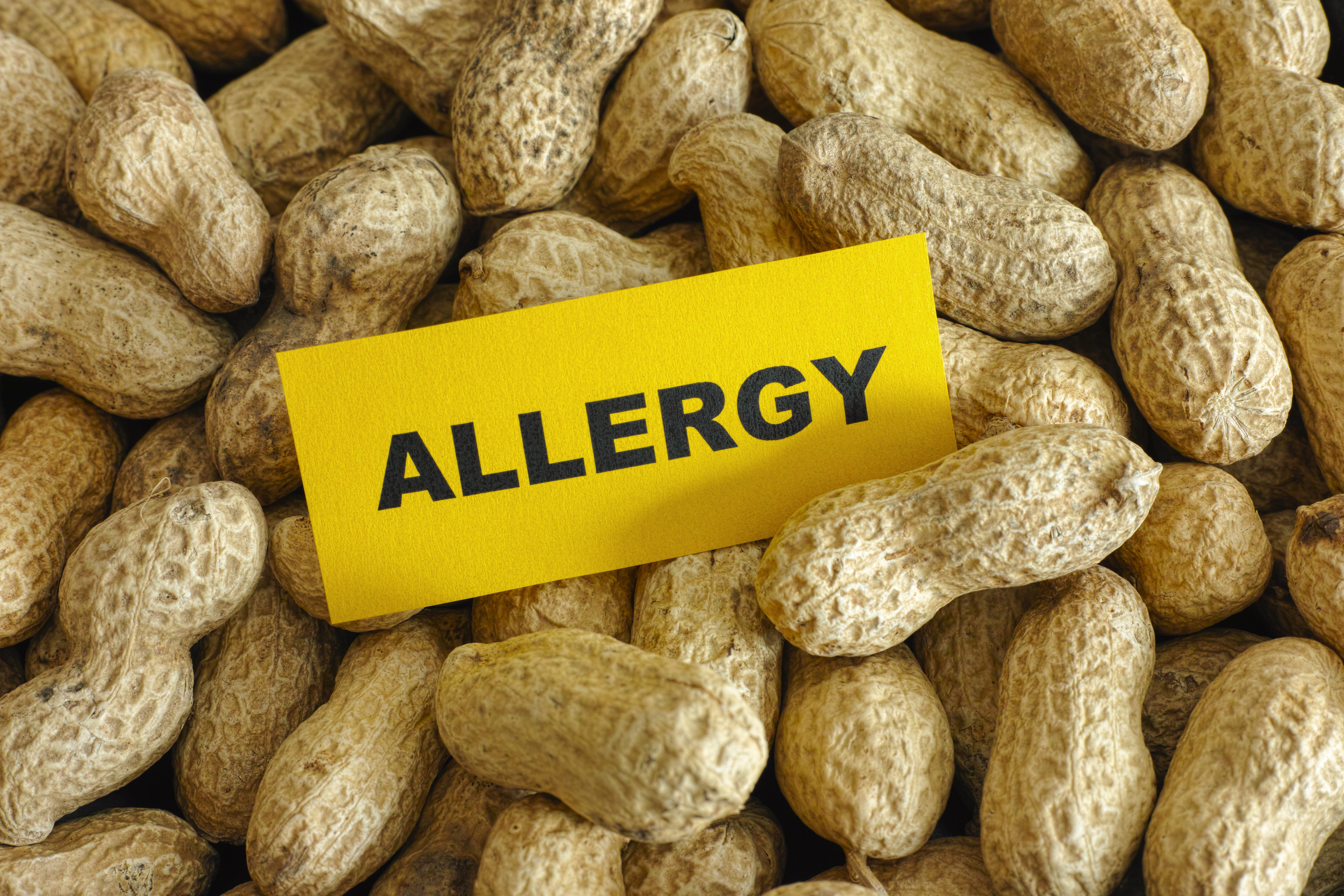 Drug Addiction: Is It An Allergy Or Not?