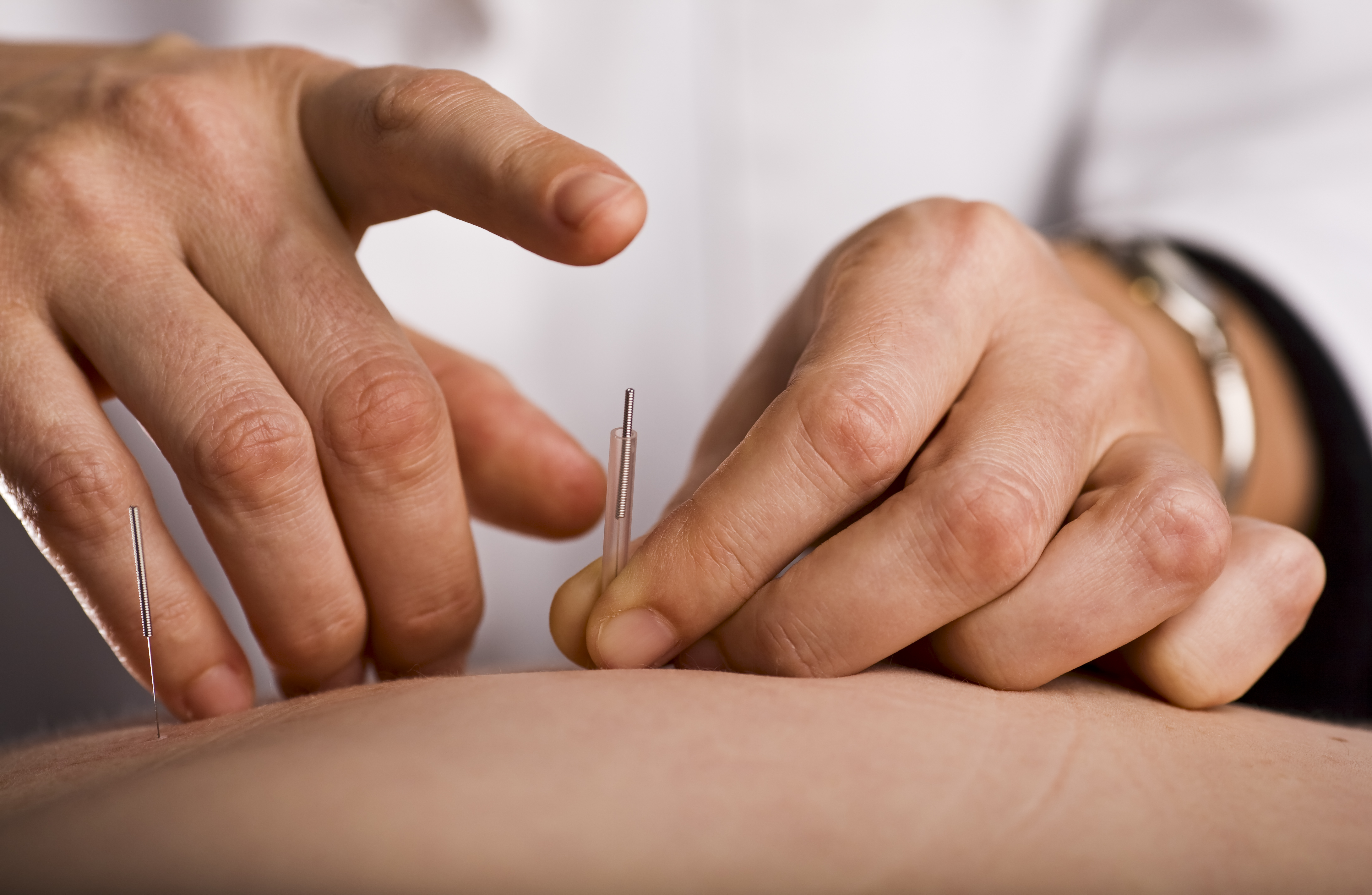 Acupuncture Can Improve Chronic Pain and Depression Treatment