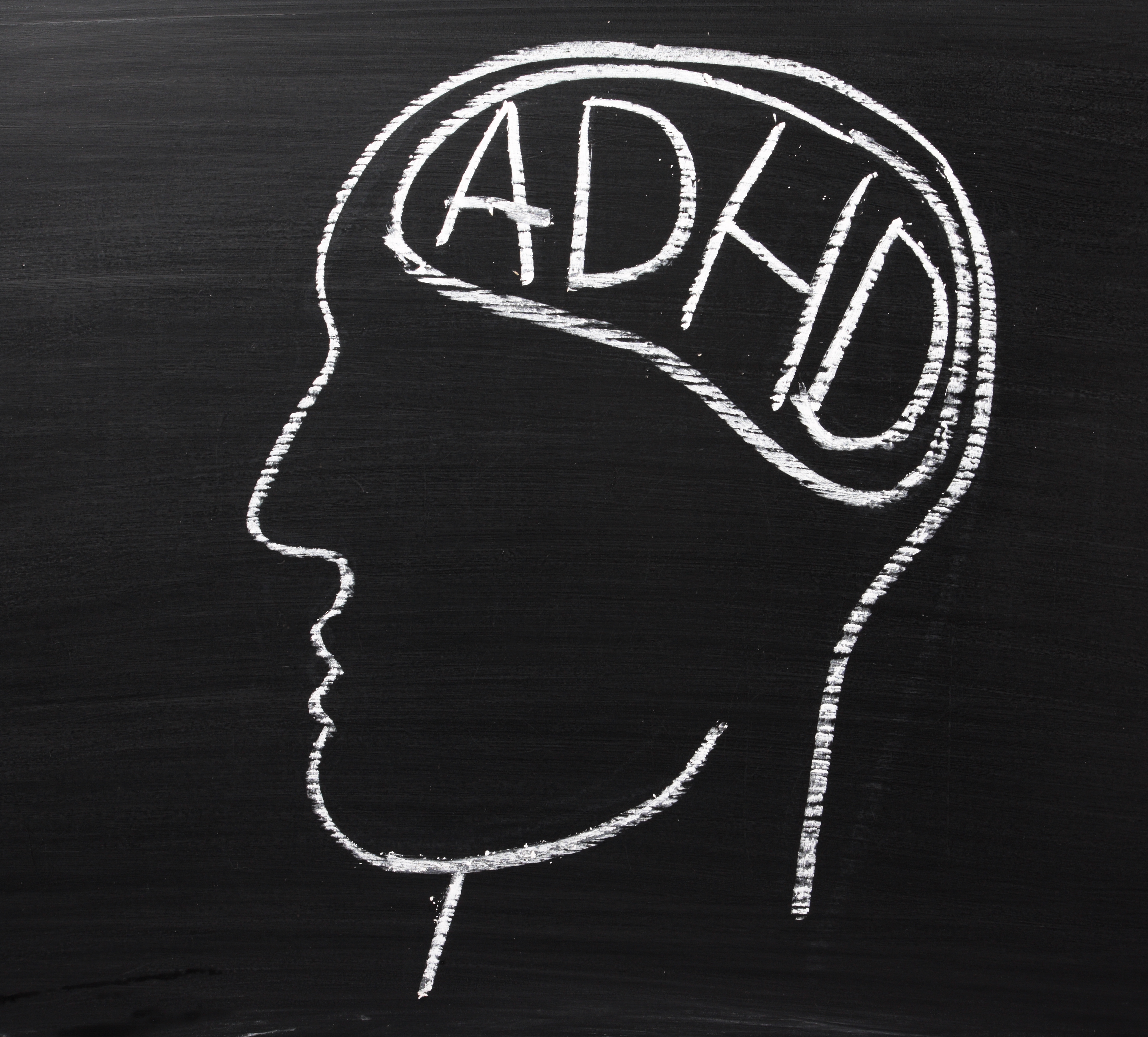 Does ADHD Lead to Substance Abuse?